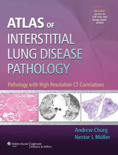 interstitial lung disease histology