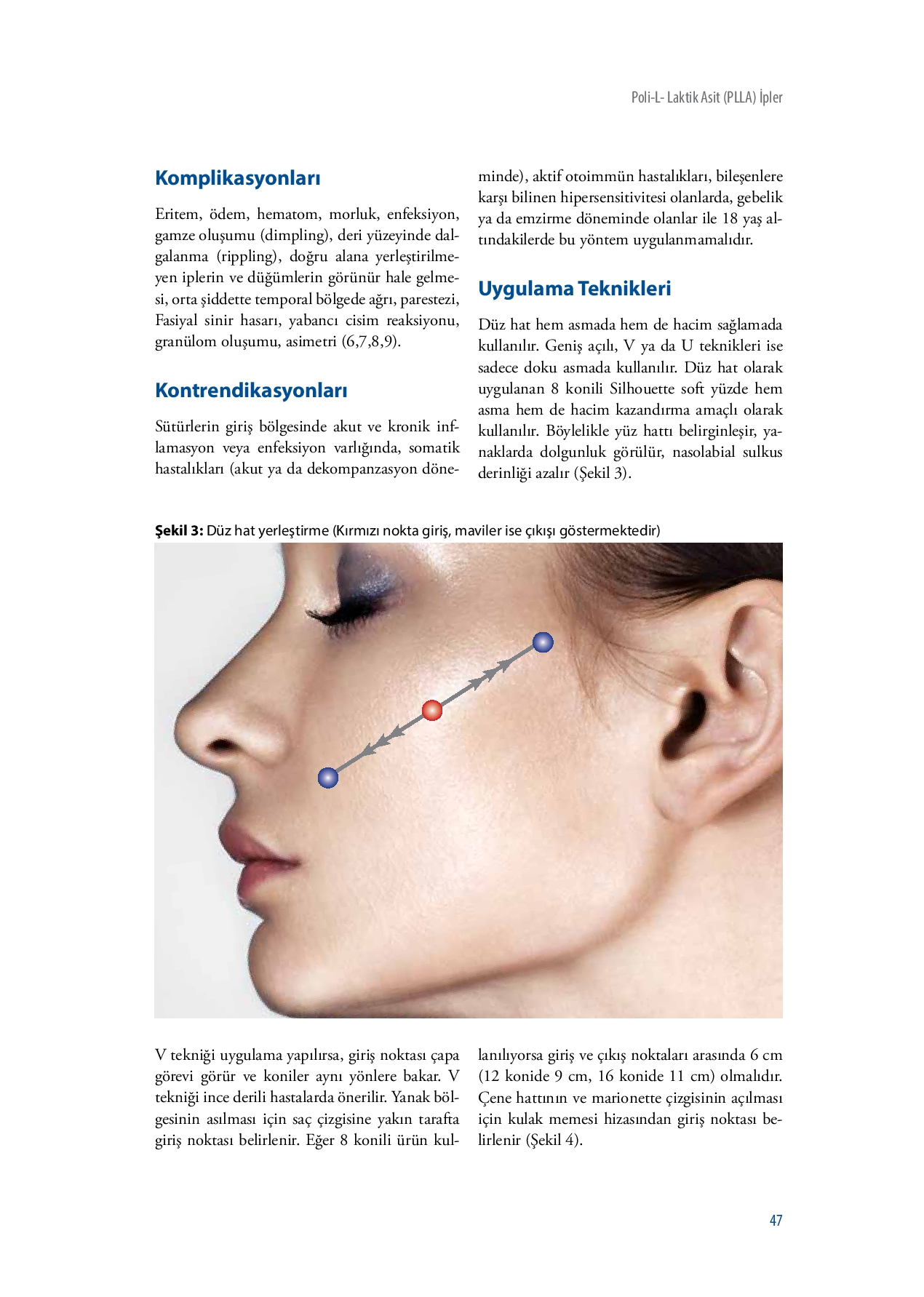 Estetik Dermatolojide İple Yüz ve Vücut Germe Teknikleri