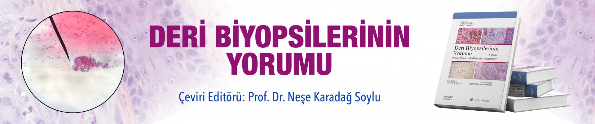 Deri Biyopsilerinin Yorumu:primer Non-Lenfoid Kutanöz NeoplaDeri Biyopsilerinin Yorumu:Primer Non-Lenfoid Kutanöz Neoplaziler 2.BASKI