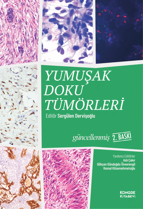 Yumuşak Doku Tümörleri 2.Baskı