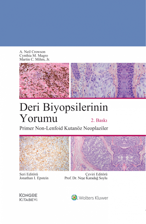 Deri Biyopsilerinin Yorumu:Primer Non-Lenfoid Kutanöz Neoplaziler 2.BASKI