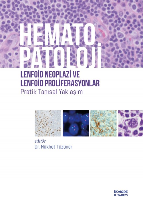 Hematopatoloji Lenfoid Neoplazi ve Lenfoid Proliferasyonlar Pratik Tanısal Yaklaşım