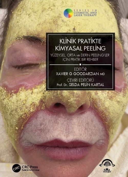 Klinik Pratikte Kimyasal Peeling