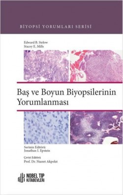 Baş ve Boyun Biyopsilerinin Yorumlanması