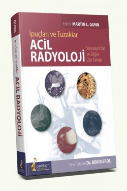 İpuçları ve Tuzaklar Acil Radyoloji