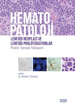 Hematopatoloji Lenfoid Neoplazi ve Lenfoid Proliferasyonlar Pratik Tanısal Yaklaşım